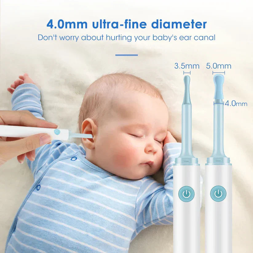 Otocam™ Limpieza de Oídos Inteligente